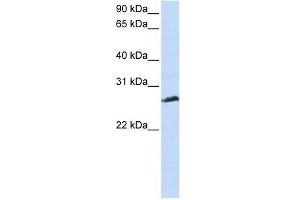 SYCP3 antibody used at 1 ug/ml to detect target protein. (SYCP3 抗体  (N-Term))
