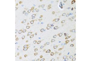 Immunohistochemistry of paraffin-embedded rat brain using OGN antibody (ABIN6131952, ABIN6145008, ABIN6145009 and ABIN6222384) at dilution of 1:100 (40x lens). (OGN 抗体  (AA 20-298))