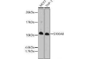Western blot analysis of extracts of various cell lines using S100A8 Polyclonal Antibody at dilution of 1:1000. (S100A8 抗体)