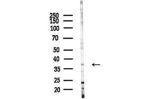 anti-PDZ and LIM Domain 3 (PDLIM3) (Internal Region) antibody
