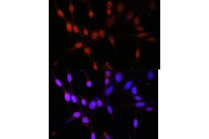 Immunofluorescence analysis of NIH/3T3 cells using KA antibody (ABIN7268768) at dilution of 1:100. (MYST3 抗体  (AA 800-1000))
