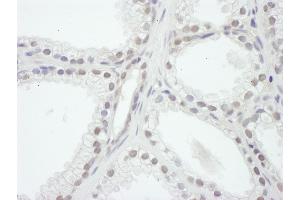 anti-Nuclear Receptor Coactivator 1 (NCOA1) (AA 600-650) antibody