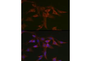 Immunofluorescence analysis of C6 cells using STA Rabbit pAb (ABIN6128540, ABIN6148576, ABIN6148578 and ABIN6223670) at dilution of 1:50 (40x lens). (STAT5A 抗体  (AA 635-794))