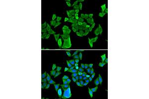 Immunofluorescence analysis of HeLa cells using CCAR1 antibody.