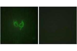 Immunofluorescence analysis of HuvEc cells, using MARK2 (Ab-596) Antibody.