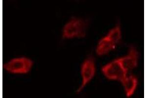 Immunofluorescence (fixed cells) (IF/ICC) image for anti-PRA1 Domain Family, Member 2 (PRAF2) (C-Term) antibody (ABIN6262707)