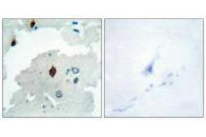 Immunohistochemistry analysis of paraffin-embedded human brain tissue using PTTG antibody. (PTTG1IP 抗体  (C-Term))