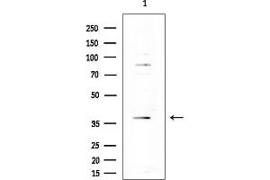 Western blot analysis of lysates from COLO205 cells(heat-shock treatment), using Amylin Antibody at 1/1000 dilution.