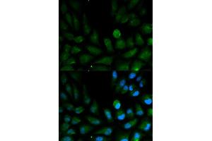 Immunofluorescence analysis of HepG2 cell using CAPZA2 antibody. (CAPZA2 抗体)