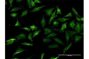 Immunofluorescence of purified MaxPab antibody to GRIPAP1 on HeLa cell. (GRIPAP1 抗体  (AA 1-841))