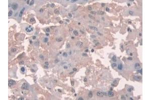 Immunohistochemistry (IHC) image for anti-NADPH Oxidase 1 (NOX1) (AA 235-488) antibody (ABIN7439315)