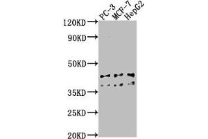 Western Blot Positive WB detected in: PC-3 whole cell lysate, MCF-7 whole cell lysate, HepG2 whole cell lysate All lanes: RHBDD3 antibody at 1:1000 Secondary Goat polyclonal to rabbit IgG at 1/50000 dilution Predicted band size: 41 kDa Observed band size: 41 kDa (RHBDD3 抗体  (AA 304-323))