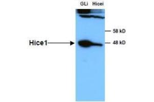 Anti-HICE1 in Western Blot using  Immunochemicals' Anti-HICE1 Antibody shows detection of a 45 kDa band corresponding to endogenous HICE1 in lysates of S phase HeLa cells silenced for either control Luciferase or HICE1. (NYS48/HAUS8 抗体)