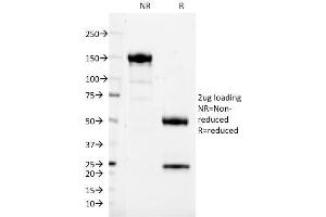 SDS-PAGE Analysis Purified CD37 Mouse Monoclonal Antibody (IPO24). (CD37 抗体)