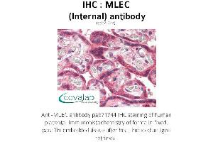 Image no. 1 for anti-Malectin (MLEC) (Internal Region) antibody (ABIN1736973) (Malectin 抗体  (Internal Region))