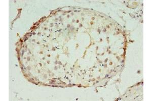 Immunohistochemistry (IHC) image for anti-Polymerase (RNA) II (DNA Directed) Polypeptide I, 14.5kDa (POLR2I) (AA 1-125) antibody (ABIN7150442)
