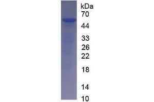 SDS-PAGE of Protein Standard from the Kit (Highly purified E. (Interleukin 35 ELISA 试剂盒)