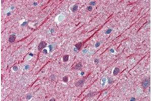 Human Brain, Cortex: Formalin-Fixed, Paraffin-Embedded (FFPE) (TUBB2A 抗体  (AA 1-446))