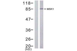 Western blot analysis of extract from HuVec cells treated or untreated with PMA (200nM, 30min), using MSK1 (Ab-376) antibody (E021198). (MSK1 抗体)