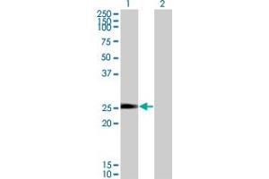 Western Blot analysis of NXNL1 expression in transfected 293T cell line by TXNL6 monoclonal antibody (M01), clone 7H3. (NXNL1 抗体  (AA 81-190))