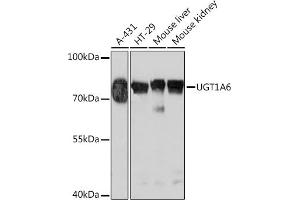 Western blot analysis of extracts of various cell lines, using UGT1 Rabbit pAb (ABIN7271193) at 1:1000 dilution. (UGT1A6 抗体  (AA 65-270))