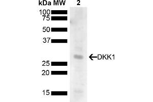 Western blot analysis of Human 293T showing detection of 28. (DKK1 抗体  (AA 120-220) (PE))