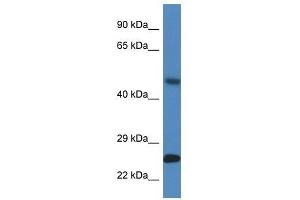 Western Blot showing Snx10 antibody used at a concentration of 1.