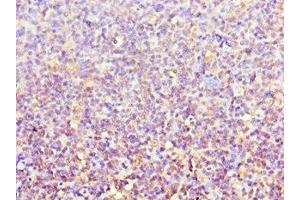 Immunohistochemistry of paraffin-embedded human tonsil tissue using ABIN7143106 at dilution of 1:100 (ACTR3B 抗体  (AA 189-418))
