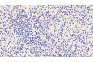 Detection of EMR1 in Human Spleen Tissue using Polyclonal Antibody to EGF Like Module Containing Mucin Like Hormone Receptor 1 (EMR1) (F4/80 抗体  (AA 1-201))