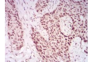 Immunohistochemistry (IHC) image for anti-Chromobox Homolog 2 (CBX2) (AA 402-525) antibody (ABIN5542422)