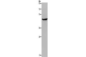 Western Blotting (WB) image for anti-Acid Phosphatase 6, Lysophosphatidic (ACP6) antibody (ABIN2430391)