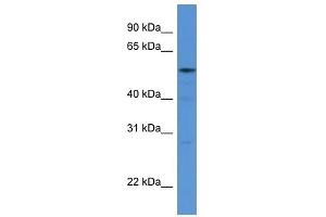 Western Blot showing HARS antibody used at a concentration of 1 ug/ml against 293T Cell Lysate (HARS1/Jo-1 抗体  (N-Term))
