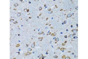 Immunohistochemistry of paraffin-embedded Mouse brain using RARS Polyclonal Antibody at dilution of 1:100 (40x lens). (RARS 抗体)