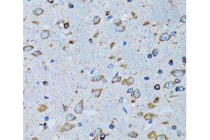 Immunohistochemistry of paraffin-embedded Mouse brain using RARS Polyclonal Antibody at dilution of 1:100 (40x lens). (RARS 抗体)