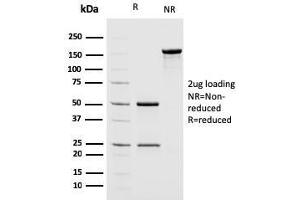 SDS-PAGE (SDS) image for anti-Mismatch Repair Protein 2 (MSH2) (AA 327-427) antibody (ABIN6940081)