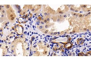 Detection of CK17 in Human Kidney Tissue using Polyclonal Antibody to Cytokeratin 17 (CK17) (KRT17 抗体  (AA 252-393))