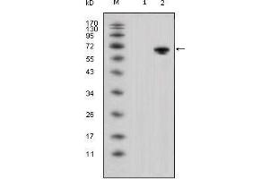 Western Blotting (WB) image for anti-Wingless-Type MMTV Integration Site Family, Member 5A (WNT5A) antibody (ABIN969460)