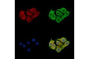 anti-G Patch Domain and Ankyrin Repeats 1 (GPANK1) antibody