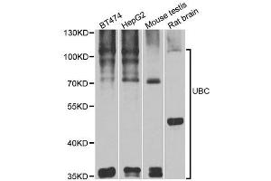 Western blot analysis of extracts of various cell lines, using UBC antibody. (UBC 抗体  (AA 1-100))