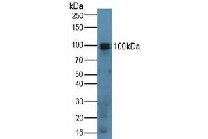 Detection of SPON1 in Mouse Lung Tissue using Polyclonal Antibody to Spondin 1 (SPON1) (SPON1 抗体  (AA 608-802))