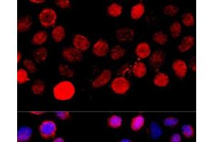 Immunofluorescence analysis of HeLa cells using BAZ1A Polyclonal Antibody at dilution of 1:100 (40x lens). (BAZ1A 抗体)