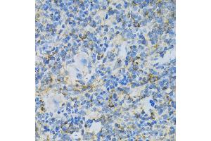 Immunohistochemistry of paraffin-embedded rat spleen using RPL13 antibody (ABIN1682571, ABIN5664631, ABIN5664633 and ABIN6220492) at dilution of 1:100 (40x lens). (RPL13 抗体  (AA 1-211))