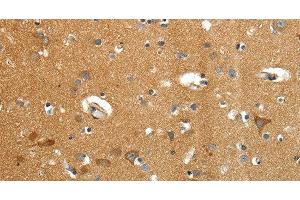 Immunohistochemistry of paraffin-embedded Human brain tissue using AMD1 Polyclonal Antibody at dilution 1:40 (AMD1 抗体)