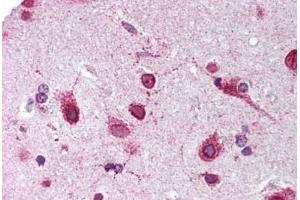 Human Brain, Cortex (formalin-fixed, paraffin-embedded) stained with PHB2 antibody ABIN239837 at 1:50 followed by biotinylated goat anti-rabbit IgG secondary antibody ABIN481713, alkaline phosphatase-streptavidin and chromogen. (Prohibitin 2 抗体  (C-Term))