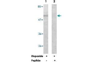 Western blot analysis of extracts from HeLa cells, treated with Etoposide (25 uM, 24 hours), using AKT1 polyclonal antibody . (AKT1 抗体)
