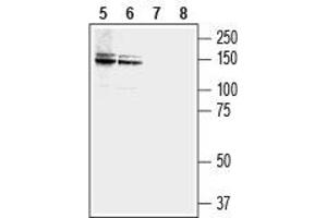 Western blot analysis of human LNCaP  prostate carcinoma (lanes 5 and 7) and MCF-7 breast adenocarcinoma (lanes 6 and 8) cell lysates: - 5,6. (NCAM2 抗体  (Extracellular, N-Term))