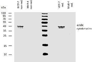 Western blotting analysis of human acidic cytokeratins using mouse monoclonal antibody AE1 on lysates of MCF-7 cell line and Molt-4 cell line (cytokeratin non-expressing cell line, negative control) under non-reducing and reducing conditions. (Keratin Acidic (AE1) 抗体)