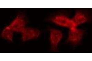 ABIN6274930 staining HepG2 by IF/ICC. (BRWD3 抗体  (C-Term))