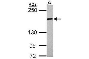 WB Image Sample (30 ug of whole cell lysate) A: HeLa 5% SDS PAGE antibody diluted at 1:1000