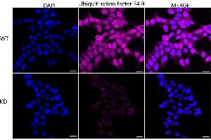 Immunocytochemical staining of HeLa cells using Ubiquitination factor E4 B antibody (ABIN7800713), 1:1,000), Top panel: wild-type (WT), Bottom panal: Ubiquitination factor E4 B shRNA knockdown (KD).